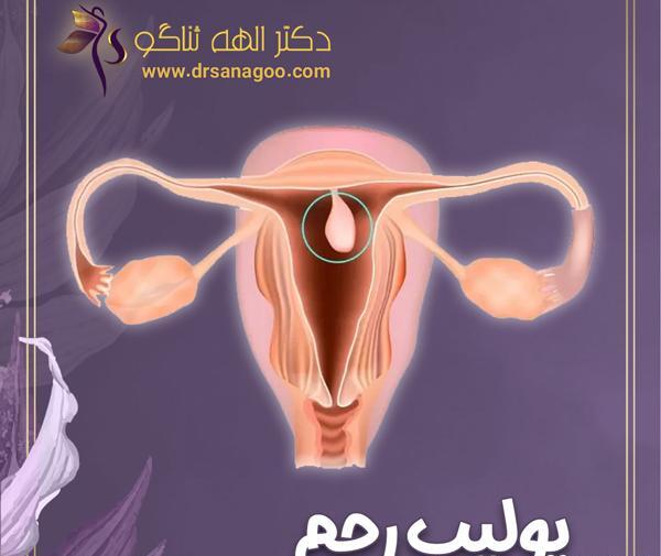 کیا دوبار عکس رنگی رحم گرفتن