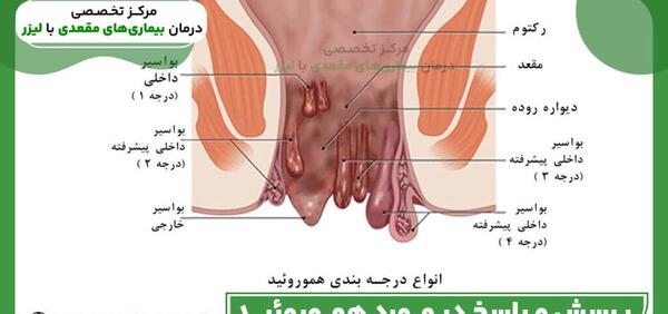 کیا عکس رنگی رحم با بیهوشی گرفتن نی نی سایت