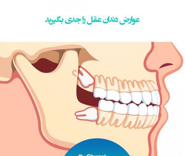کیا تو بارداری عکس دندون گرفتن