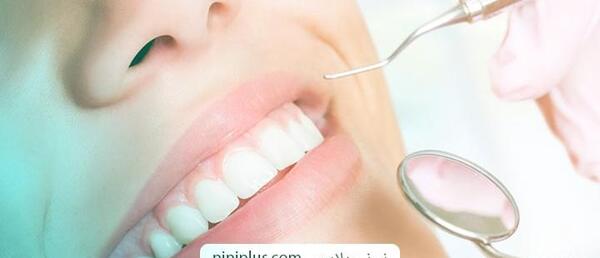 کیا تو بارداری عکس دندون گرفتن