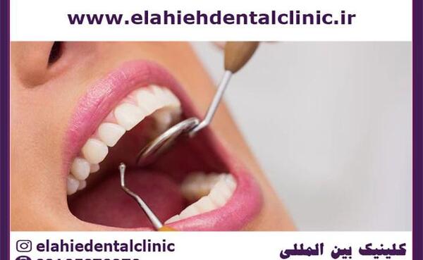کیا تو بارداری عکس دندون گرفتن