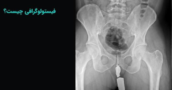 کیا تو بارداری عکس رادیولوژی گرفتن