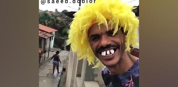 عکس ممد قلی دندان چیست