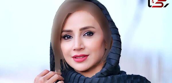 عکس ممد قلی دندان چیست
