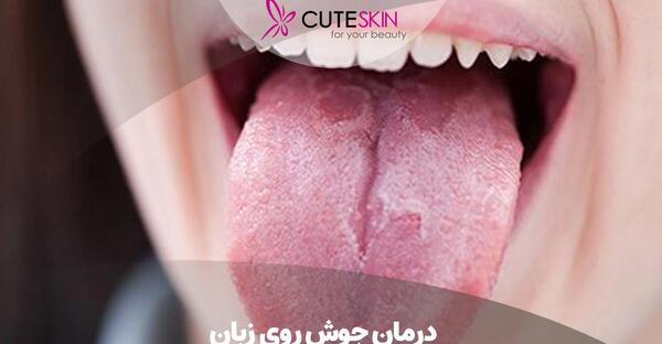 عکس دوون لارات