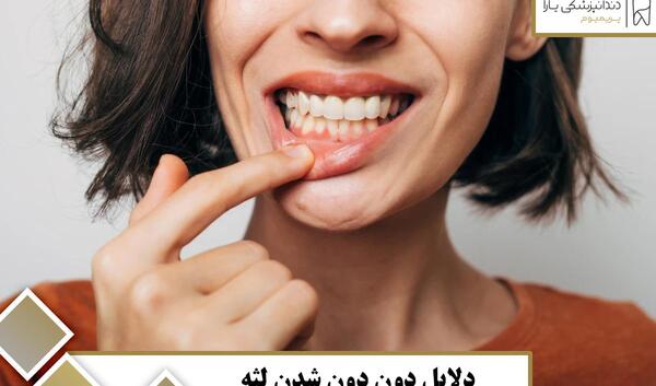 عکس دوون لارات