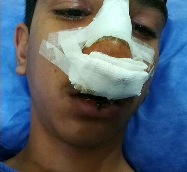 عکس ممد قلی زشت و بد
