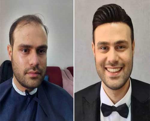 عکس ارایش داماد