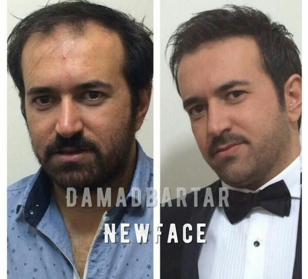 عکس ارایش داماد