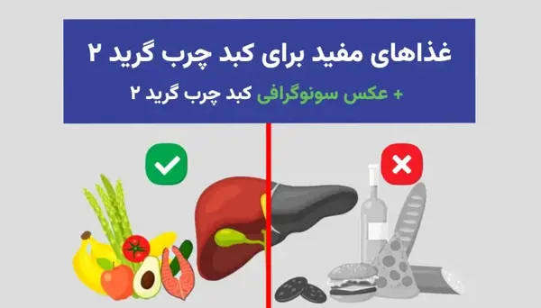 عکس کبد چرب گرید 2