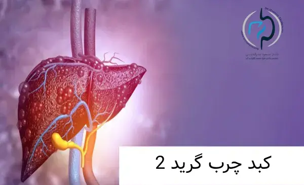 عکس کبد چرب گرید 2