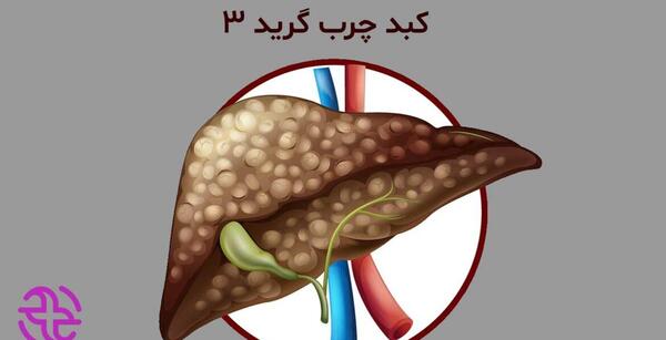 عکس کبد چرب گرید 3