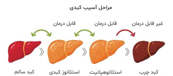 عکس کبد چرب گرید 3