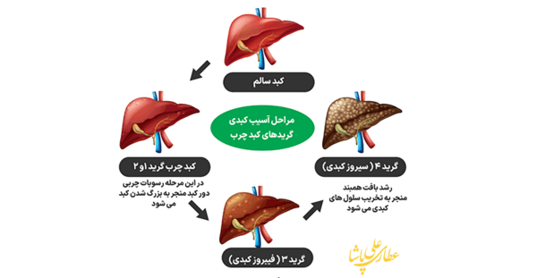 عکس کبد چرب گرید 4