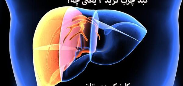 عکس کبد چرب گرید 4