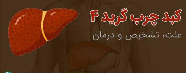 عکس کبد چرب گرید 4