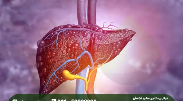 عکس کبد چرب گرید 4