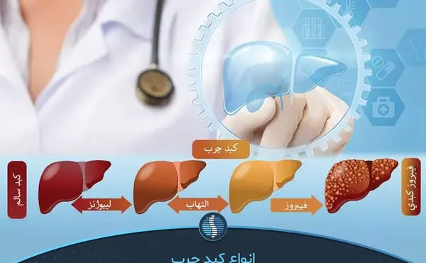 عکس کبد چرب گرید 4