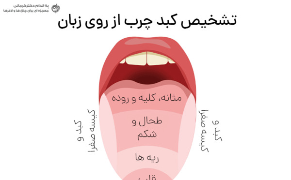 عکس کبد چرب در سونوگرافی