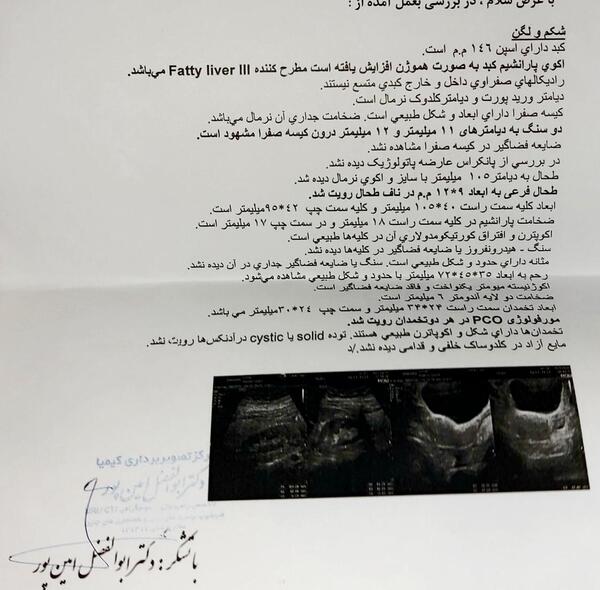 عکس کبد چرب در سونوگرافی