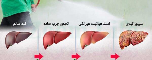 عکس کبد چرب و سالم