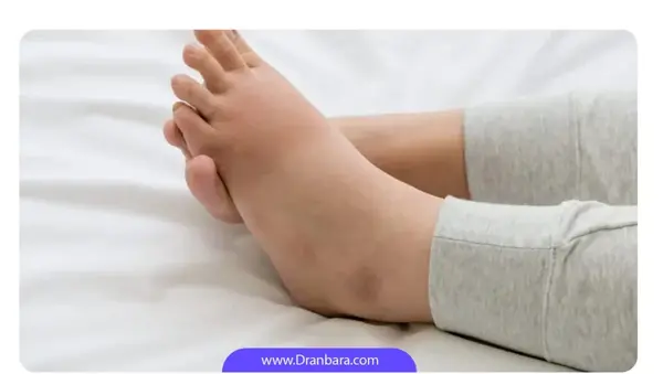 عکس کبد چرب واقعی