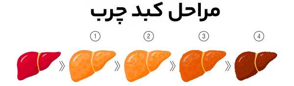 عکس کبد چرب واقعی