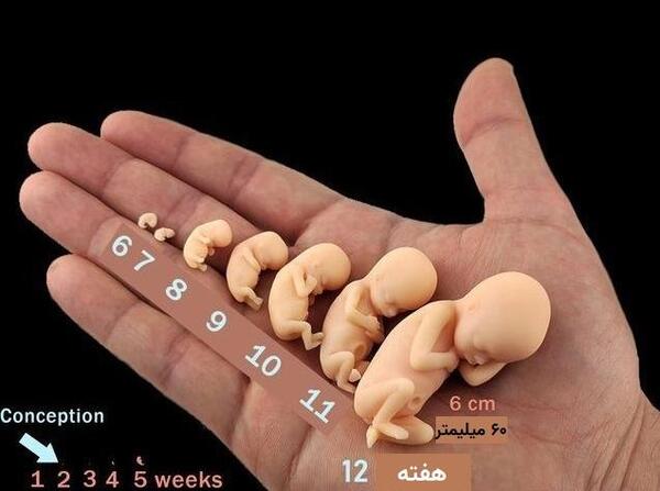 عکس جنین در بیست و هشت هفته