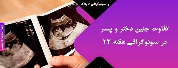 عکس جنین بیست و سه هفته دختر