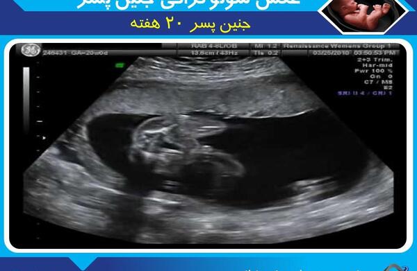 عکس جنین بیست سه هفته