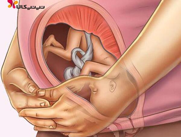 عکس جنین در هفته بیست و سوم بارداری