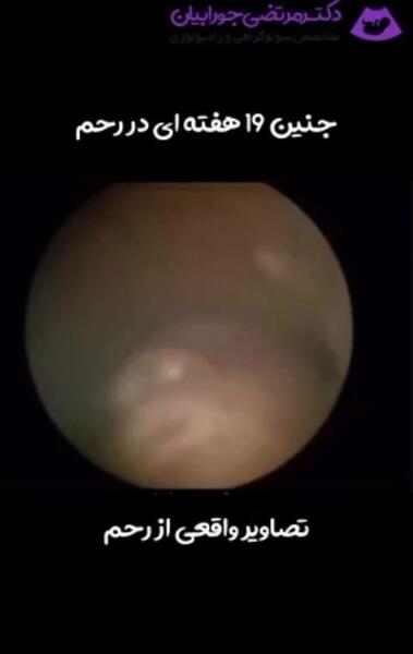 عکس جنین بیست پنج هفته