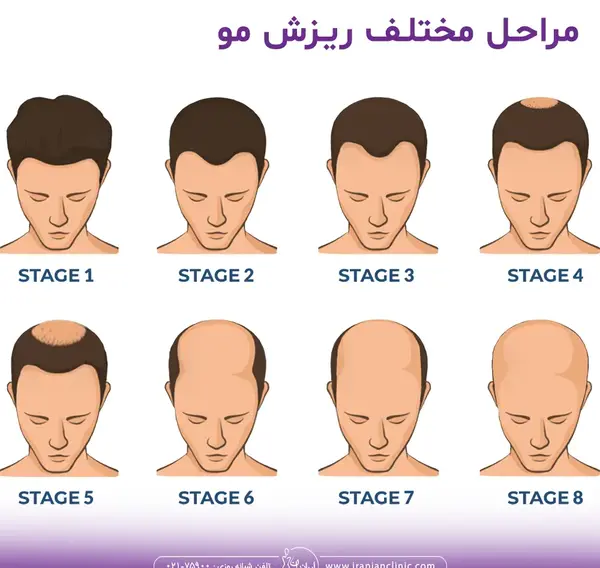 عکس ممد قلی کچلی