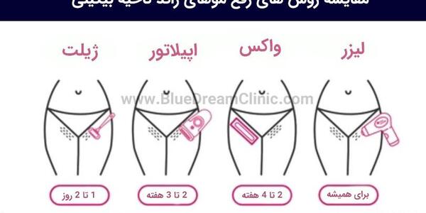 عکس اپیلاسیون ناحیه تناسلی نی نی سایت