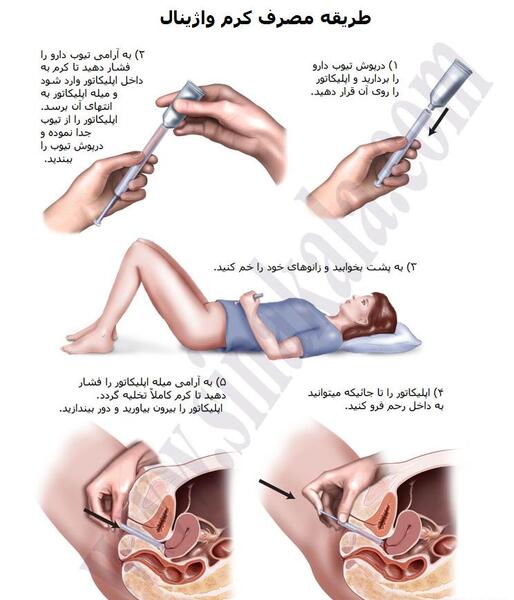 عکس اپلیکاتور واژینال