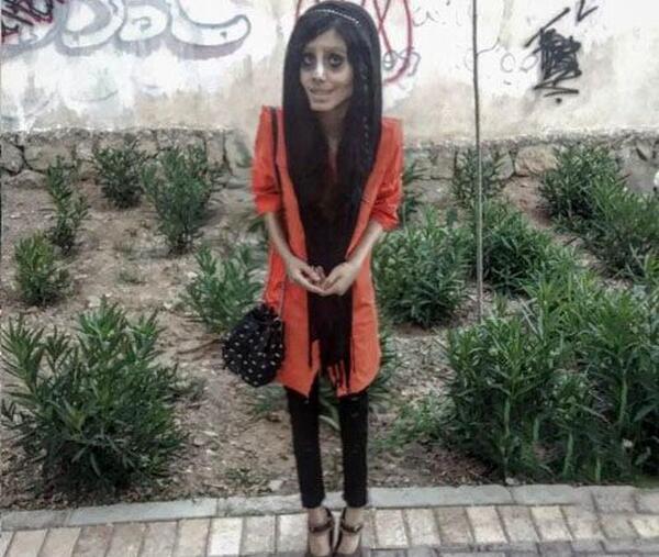 عکس دختر زشت سیاه
