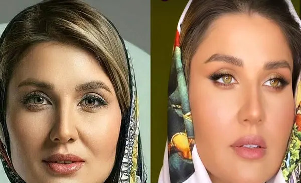 عکس گلزار در گروه آرین