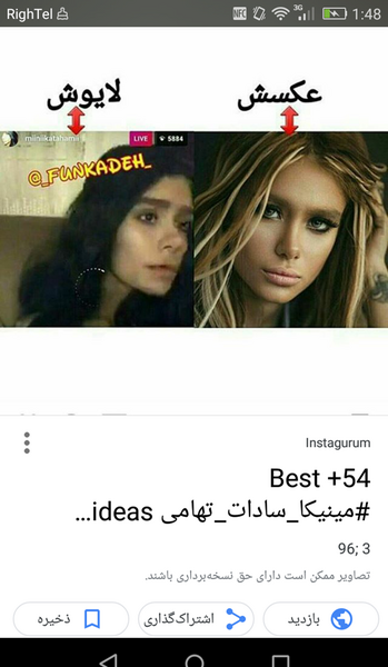 عکس ملیکا تهامی قبل عمل