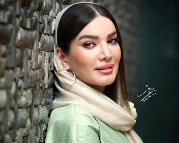عکس متین ستوده قبل از عمل زیبایی