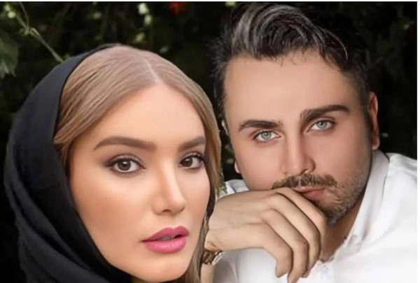 عکس متین ستوده قبل از عمل زیبایی