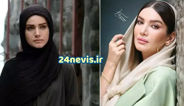 عکس متین ستوده قبل از عمل زیبایی