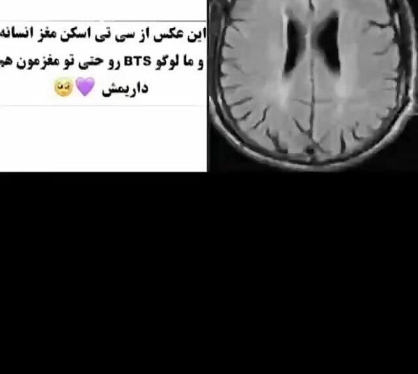 عکس از لوگو بی تی اس