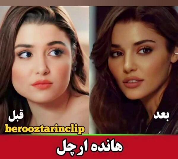 عکس هانده ارچل قدیم