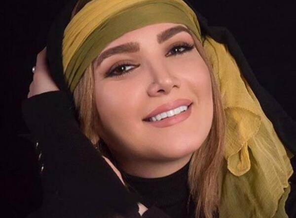 عکس بازیگران ایرانی که دندان مصنوعی دارند
