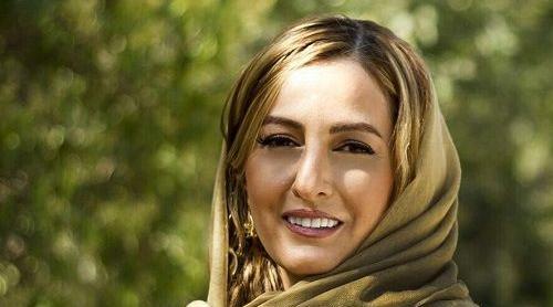 عکس بازیگران ایرانی که دندان مصنوعی دارند