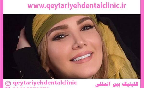 عکس بازیگران ایرانی که دندان مصنوعی دارند