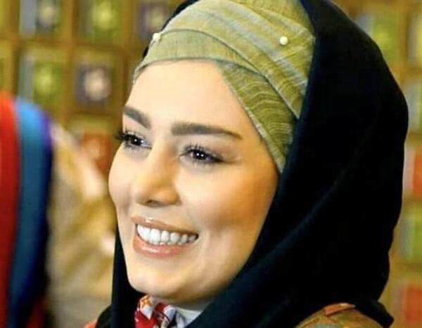 عکس بازیگران ایرانی که دندان مصنوعی دارند