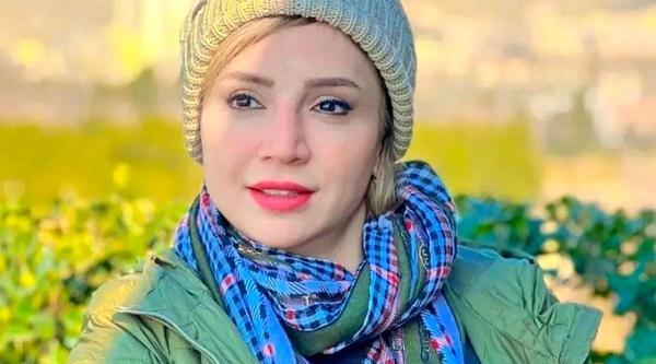 عکس بازیگران زن ایرانی قبل از عمل زیبایی