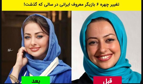 عکس بازیگران زن ایرانی قبل از عمل زیبایی