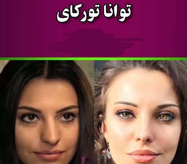 عکس بازیگران زن ایرانی قبل از عمل زیبایی